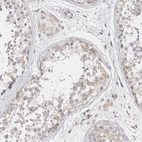 Immunohistochemical staining of human testis shows weak cytoplasmic positivity in Leydig cells and subset of cells in seminiferous ducts.