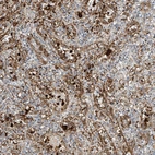 Immunohistochemical staining of human spleen shows strong cytoplasmic positivity in sinusoids cells and histiocytes.