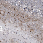 Immunohistochemical staining of human tonsil shows strong cytoplasmic positivity in squamous epithelial cells.