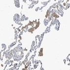 Immunohistochemical staining of human lung shows strong cytoplasmic positivity in macrophages.