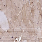 Immunohistochemical staining of human skeletal muscle shows moderate cytoplasmic positivity in myocytes in addition to weak nuclear positivity.