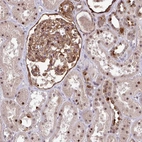 Immunohistochemical staining of human kidney shows strong cytoplasmic positivity in cells in glomeruli in addition to nuclear positivity in cells in tubules.