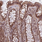 Immunohistochemical staining of human colon shows moderate cytoplasmic positivity in glandular cells in addition to moderate nuclear positivity.