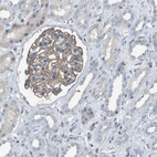Immunohistochemical staining of human kidney shows moderate membranous positivity in cells in glomeruli.