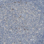 Immunohistochemical staining of human lymphoid tissues shows moderate membranous positivity in subset of germinal center cells.