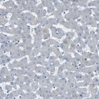 Immunohistochemical staining of human liver shows no positivity in hepatocytes as expected.