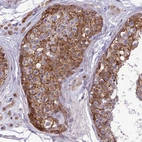 Immunohistochemical staining of human testis shows strong cytoplasmic-membranous positivity in cells in seminiferous ducts.