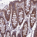 Immunohistochemical staining of human colon shows strong cytoplasmic positivity in glandular cells.