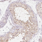 Immunohistochemical staining of human testis shows moderate cytoplasmic positivity in cells in seminiferous ducts.