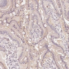 Immunohistochemical staining of human upper duodenum shows weak cytoplasmic positivity in glandular cells.