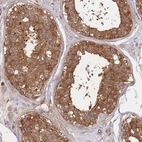 Immunohistochemical staining of human testis shows strong membranous-cytoplasmic positivity in cells in seminiferous ducts.