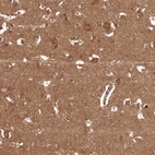 Immunohistochemical staining of human cerebral cortex shows strong membranous-cytoplasmic positivity in neurons with additional cytoplasmic positivity in neuropil.