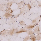 Immunohistochemical staining of human skeletal muscle shows moderate cytoplasmic positivity in subset of cells in myocytes.