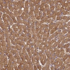 Immunohistochemical staining of human liver shows strong cytoplasmic positivity in hepatocytes.