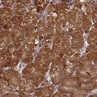 Immunohistochemical staining of human stomach shows strong cytoplasmic positivity in glandular cells.