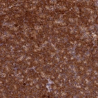 Immunohistochemical staining of human pancreas shows strong cytoplasmic positivity in exocrine glandular cells in addition to nuclear membranous positivity.