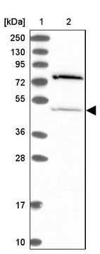 Lane 1: Marker [kDa] 250, 130, 95, 72, 55, 36, 28, 17, 10_br/_Lane 2: Human cell line RT-4