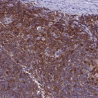 Immunohistochemical staining of human tonsil shows strong positivity in nuclear membrane in non-germinal center cells with additional cytoplasmic background.
