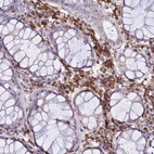 Immunohistochemical staining of human rectum shows strong positivity in nuclear membrane in lymphoid cells with additional cytoplasmic positivity.
