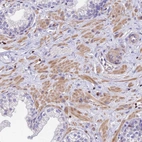 Immunohistochemical staining of human prostate shows moderate cytoplasmic positivity in smooth muscle cells.