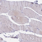 Immunohistochemical staining of human skeletal muscle shows weak cytoplasmic positivity in a subset of myocytes.
