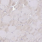Immunohistochemical staining of human skeletal muscle shows very weak positivity in cytoplasm granular in myocytes.