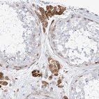 Immunohistochemical staining of human testis shows strong cytoplasmic positivity in Leydig cells with additional nuclear membranous positivity.