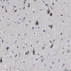 Immunohistochemical staining of human cerebral cortex shows strong cytoplasmic positivity in neuronal cells.