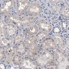 Immunohistochemical staining of human kidney shows weak cytoplasmic positivity in cells in tubules.