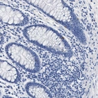 Immunohistochemical staining of human colon shows strong cytoplasmic positivity in subset of 
enterocytes.