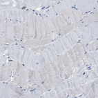 Immunohistochemical staining of human skeletal muscle shows no positivity in myocytes.