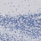 Immunohistochemical staining of human cerebellum shows no positivity in Purkinje cells.