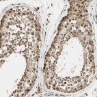 Immunohistochemical staining of human testis shows moderate nuclear positivity in cells in seminiferous ducts with additional cytoplasmic positivity.