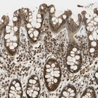 Immunohistochemical staining of human colon shows strong nuclear positivity in glandular cells and lymphoid cells with additional cytoplasmic positivity.