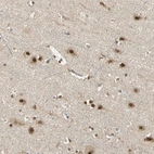 Immunohistochemical staining of human cerebral cortex shows strong nuclear positivity in neuronal cells with additional cytoplasmic and nucleoli positivity.