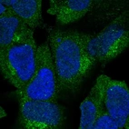 Immunofluorescent staining of human cell line HEK 293 shows localization to cytosol.