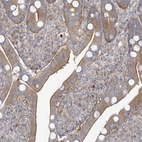 Immunohistochemical staining of human duodenum shows moderate cytoplasmic positivity in lymphoid cells.