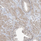 Immunohistochemical staining of human prostate shows moderate cytoplasmic positivity in smooth muscle cells.