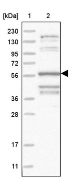 Lane 1: Marker [kDa] 230, 130, 95, 72, 56, 36, 28, 17, 11_br/_Lane 2: Human cell line RT-4