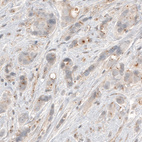 Anti-CDK5RAP2 Antibody