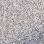 Immunohistochemical staining of human tonsil shows centrosome-like positivity in lymphoid cells.