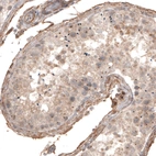 Immunohistochemical staining of human testis shows centrosome-like immunoreactivity in a subset of seminiferous epithelium cells.