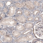 Immunohistochemical staining of human kidney shows centrosome-like positivity in renal cells.