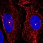 Immunofluorescence staining of U2OS cells using the anti-CDK5RAP2 monoclonal antibody, showing specific staining of the centrosome in green. Microtubule- and nuclear probes are visualized in red and blue, respectively (where available).