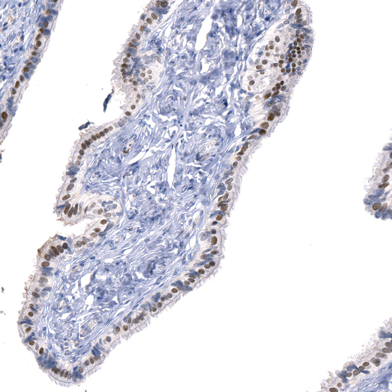 Anti-ATF3 Recombinant Antibody