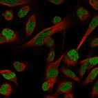 Immunofluorescence staining of RH-30 cells using the Anti-ATF3 monoclonal antibody, showing specific staining in the nucleoplasm in green. Microtubule- and nuclear probes are visualized in red and blue, respectively (where available).