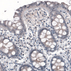 Anti-CEP350 Antibody