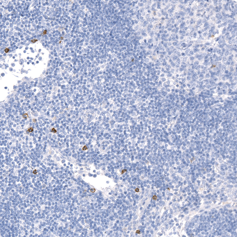 Anti-KIT Recombinant Antibody