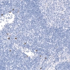 Anti-KIT Recombinant Antibody