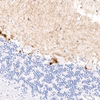 Immunohistochemical staining of human cerebellum shows moderate to strong positivity in the molecular layer.